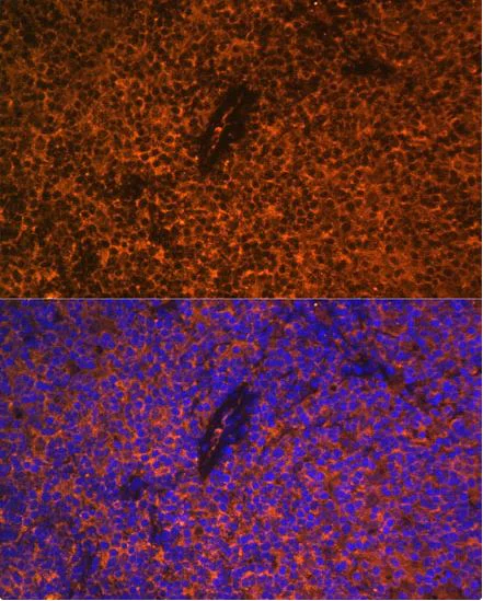 Immunocytochemistry/ Immunofluorescence - Anti-CD27 antibody (AB175403)
