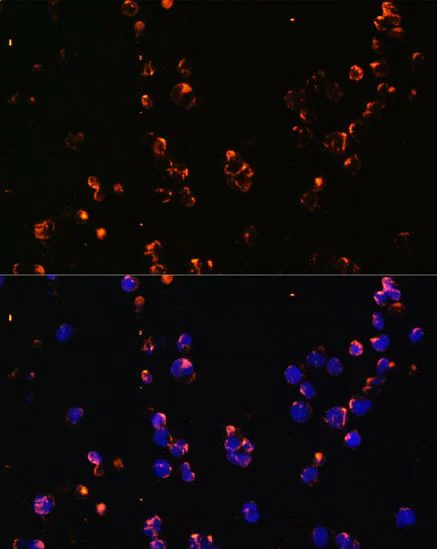 Immunocytochemistry/ Immunofluorescence - Anti-CD27 antibody (AB175403)