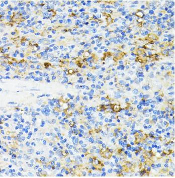 Immunohistochemistry (Formalin/PFA-fixed paraffin-embedded sections) - Anti-CD27 antibody (AB175403)