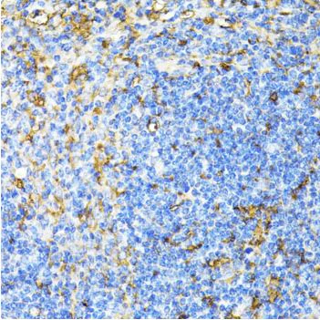 Immunohistochemistry (Formalin/PFA-fixed paraffin-embedded sections) - Anti-CD27 antibody (AB175403)
