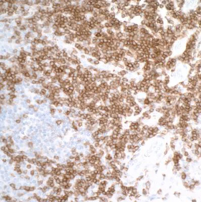 Immunohistochemistry (Formalin/PFA-fixed paraffin-embedded sections) - Anti-CD27 antibody [BLR083G] (AB265589)