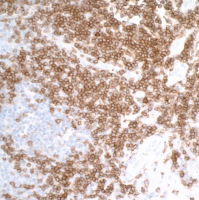 Immunohistochemistry (Formalin/PFA-fixed paraffin-embedded sections) - Anti-CD27 antibody [BLR083G] - BSA free (AB272072), expandable thumbnail