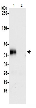 Immunoprecipitation - Anti-CD27 antibody [BLR083G] - BSA free (AB272072), expandable thumbnail