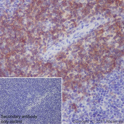 Immunohistochemistry (Formalin/PFA-fixed paraffin-embedded sections) - Anti-CD27 antibody [EPR20585] - BSA and Azide free (AB236155)