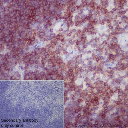 Immunohistochemistry (Formalin/PFA-fixed paraffin-embedded sections) - Anti-CD27 antibody [EPR20585] - BSA and Azide free (AB236155)