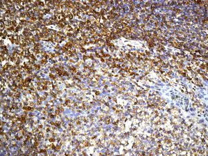 Immunohistochemistry (Formalin/PFA-fixed paraffin-embedded sections) - Anti-CD27 antibody [EPR8569] (AB131254)