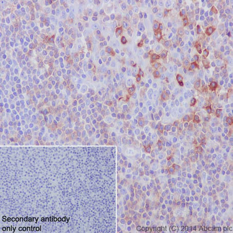 Immunohistochemistry (Formalin/PFA-fixed paraffin-embedded sections) - Anti-CD27 antibody [EPR8569] (AB131254)