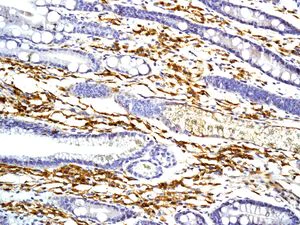 Immunohistochemistry (Formalin/PFA-fixed paraffin-embedded sections) - Anti-CD27 antibody [EPR8569] - BSA and Azide free (AB256583)