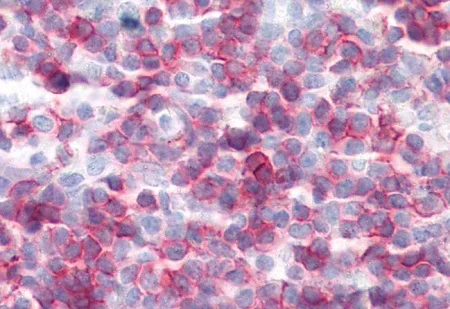 Immunohistochemistry (Formalin/PFA-fixed paraffin-embedded sections) - Anti-CD27 antibody [LG.3A10] (AB219779)