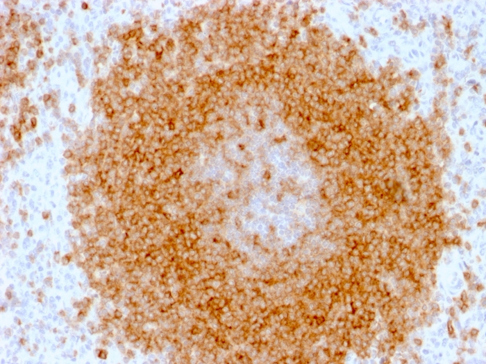 Immunohistochemistry (Formalin/PFA-fixed paraffin-embedded sections) - Anti-CD27 antibody [LPFS2/1611] - BSA and Azide free (AB268268), expandable thumbnail