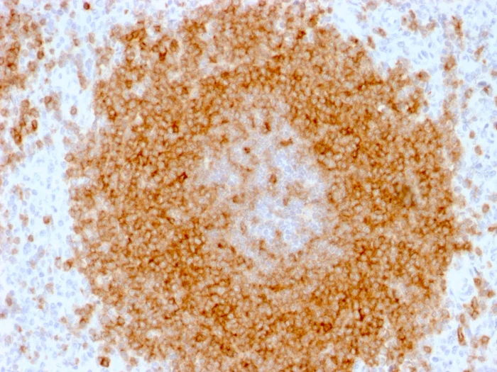 Immunohistochemistry (Formalin/PFA-fixed paraffin-embedded sections) - Anti-CD27 antibody [LPFS2/1611] - BSA and Azide free (AB268268)