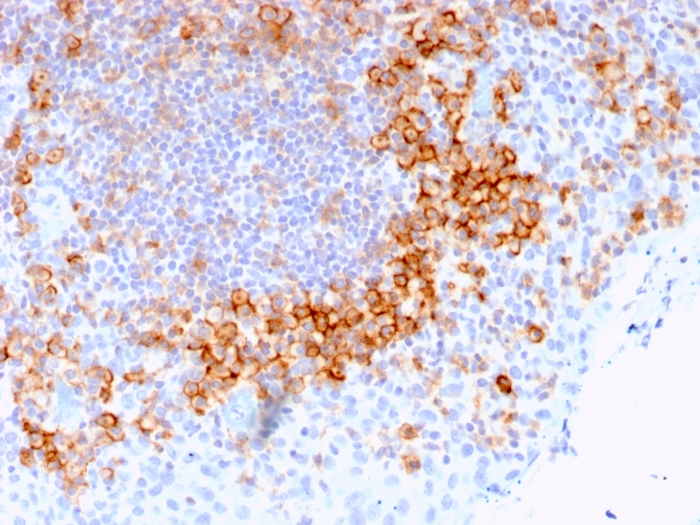 Immunohistochemistry (Formalin/PFA-fixed paraffin-embedded sections) - Anti-CD27 antibody [LPFS2/1611] - BSA and Azide free (AB268268), expandable thumbnail