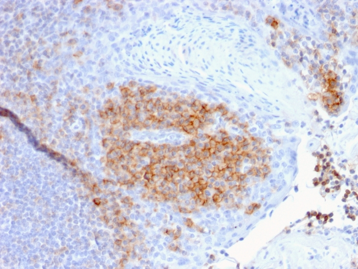 Immunohistochemistry (Formalin/PFA-fixed paraffin-embedded sections) - Anti-CD27 antibody [LPFS2/1611] - BSA and Azide free (ab268268), expandable thumbnail