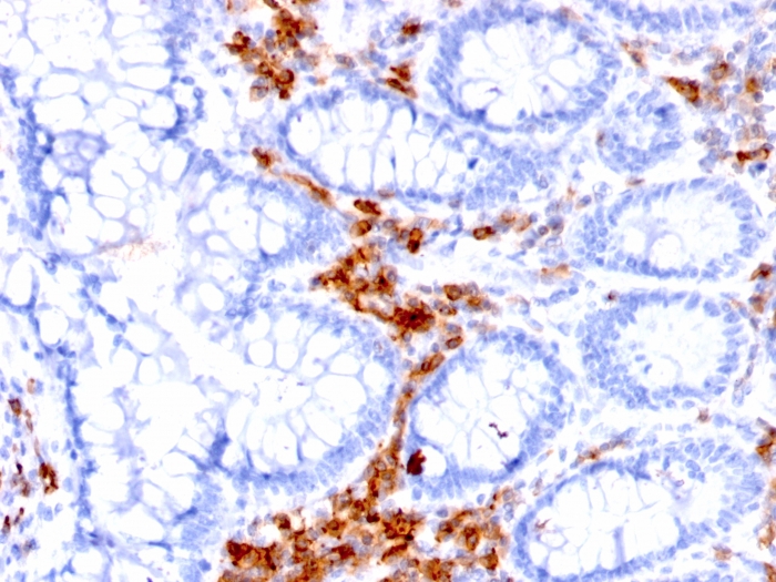 Immunohistochemistry (Formalin/PFA-fixed paraffin-embedded sections) - Anti-CD27 antibody [LPFS2/1611] - BSA and Azide free (ab268268), expandable thumbnail
