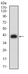 Western blot - Anti-CD272/BTLA antibody [7B8B4] (AB233733)