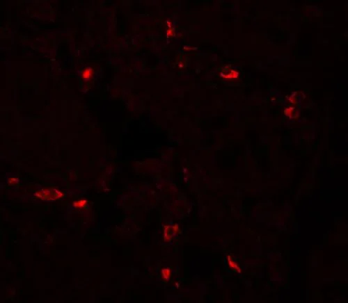 Immunocytochemistry/ Immunofluorescence - Anti-CD272/BTLA antibody (AB181406)