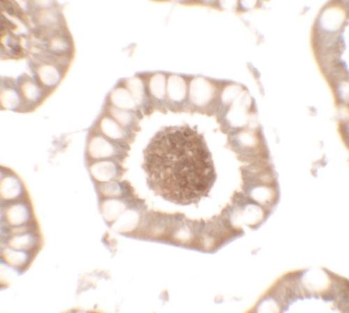 Immunohistochemistry (Formalin/PFA-fixed paraffin-embedded sections) - Anti-CD272/BTLA antibody (AB181406)
