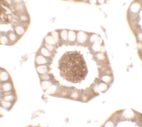 Immunohistochemistry (Formalin/PFA-fixed paraffin-embedded sections) - Anti-CD272/BTLA antibody (AB181406)