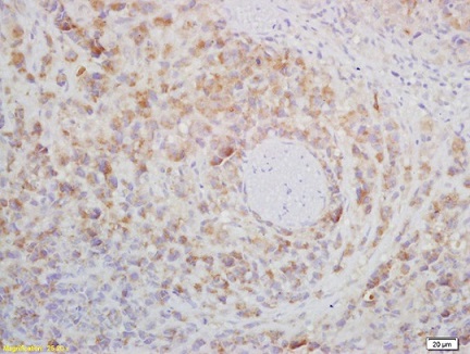 Immunohistochemistry (Formalin/PFA-fixed paraffin-embedded sections) - Anti-CD272/BTLA antibody (AB216505), expandable thumbnail