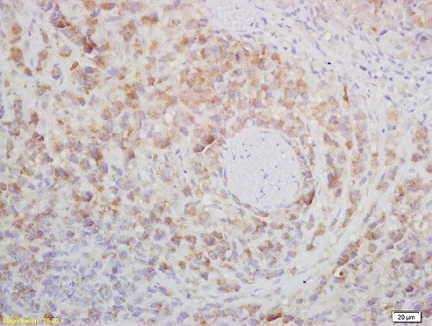 Immunohistochemistry (Formalin/PFA-fixed paraffin-embedded sections) - Anti-CD272/BTLA antibody (AB216505)