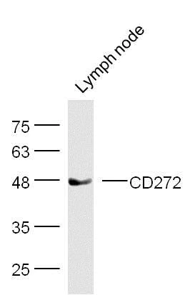 Western blot - Anti-CD272/BTLA antibody (AB216505)