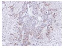 Immunohistochemistry (Formalin/PFA-fixed paraffin-embedded sections) - Anti-CD272/BTLA antibody (AB96560)