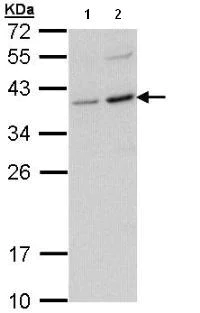 Western blot - Anti-CD272/BTLA antibody (AB96560)