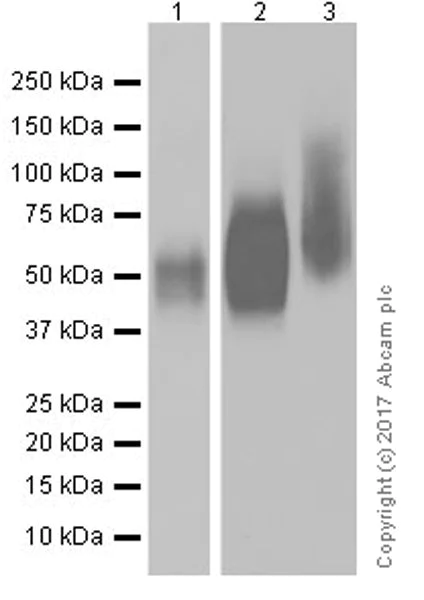 Western blot - Anti-CD272/BTLA antibody [EPR20539] (AB212089)