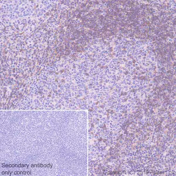 Immunohistochemistry (Formalin/PFA-fixed paraffin-embedded sections) - Anti-CD272/BTLA antibody [EPR22224-271] (AB230976)