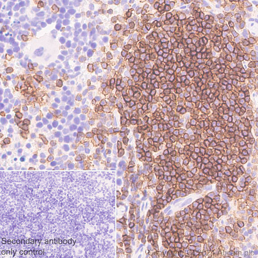 Immunohistochemistry (Formalin/PFA-fixed paraffin-embedded sections) - Anti-CD272/BTLA antibody [EPR29068-115] (AB317827), expandable thumbnail
