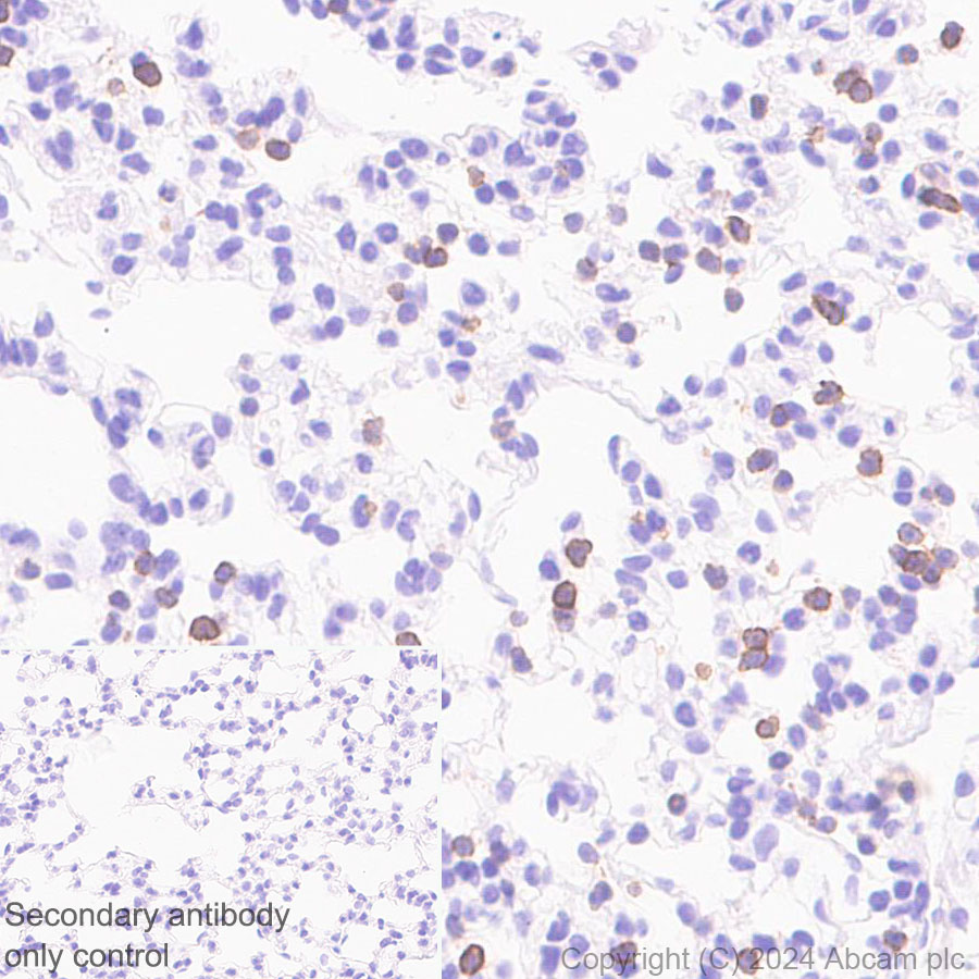 Immunohistochemistry (Formalin/PFA-fixed paraffin-embedded sections) - Anti-CD272/BTLA antibody [EPR29068-115] (AB317827), expandable thumbnail