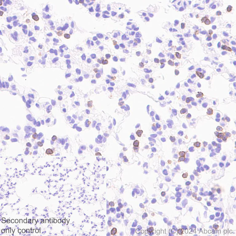 Immunohistochemistry (Formalin/PFA-fixed paraffin-embedded sections) - Anti-CD272/BTLA antibody [EPR29068-115] (AB317827)