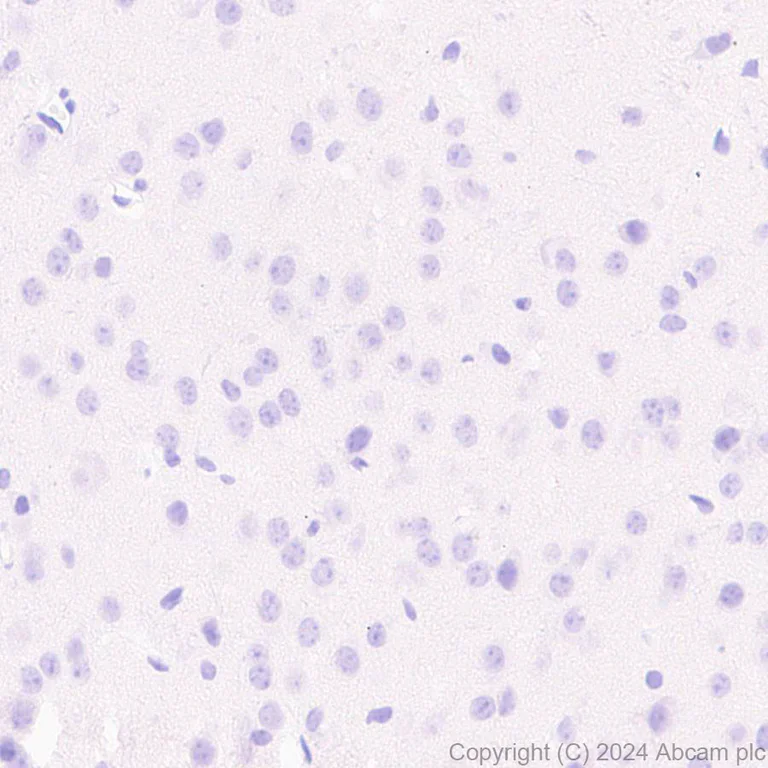 Immunohistochemistry (Formalin/PFA-fixed paraffin-embedded sections) - Anti-CD272/BTLA antibody [EPR29068-115] (AB317827)
