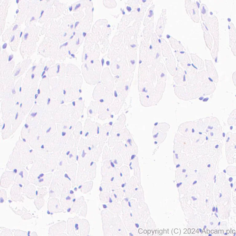 Immunohistochemistry (Formalin/PFA-fixed paraffin-embedded sections) - Anti-CD272/BTLA antibody [EPR29068-115] (AB317827)
