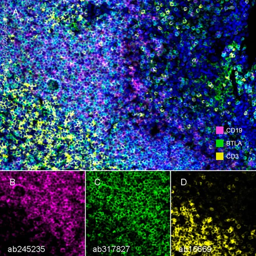 Multiplex immunohistochemistry - Anti-CD272/BTLA antibody [EPR29068-115] (AB317827)