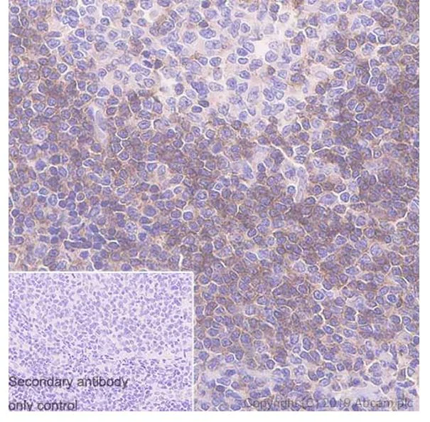 Immunohistochemistry (Formalin/PFA-fixed paraffin-embedded sections) - Anti-CD272/BTLA antibody [FLO67B] - BSA and Azide free (AB252799)