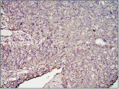 Immunohistochemistry (Formalin/PFA-fixed paraffin-embedded sections) - Anti-CD276 antibody [6A1] (AB105922), expandable thumbnail