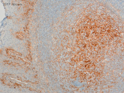 Immunohistochemistry (Formalin/PFA-fixed paraffin-embedded sections) - Anti-CD276 antibody [6A1] (AB105922), expandable thumbnail