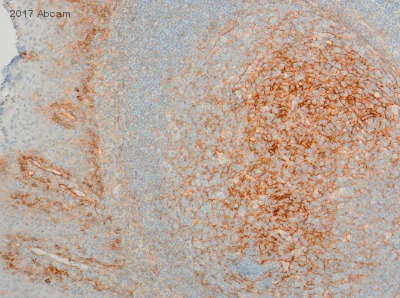 Immunohistochemistry (Formalin/PFA-fixed paraffin-embedded sections) - Anti-CD276 antibody [6A1] (AB105922)
