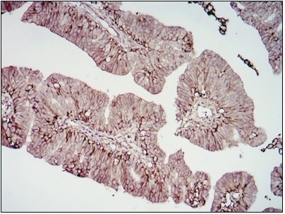 Immunohistochemistry (Formalin/PFA-fixed paraffin-embedded sections) - Anti-CD276 antibody [6A1] (AB105922), expandable thumbnail