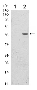 Western blot - Anti-CD276 antibody [6A1] (AB105922), expandable thumbnail