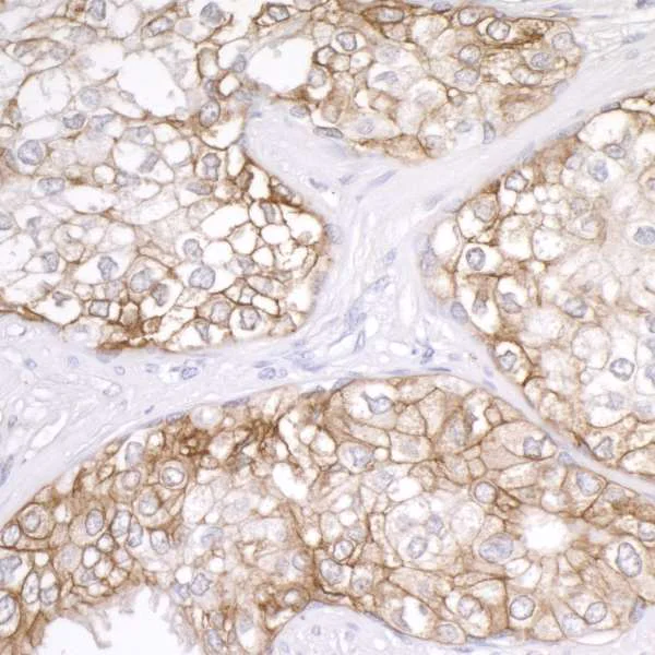 Immunohistochemistry (Formalin/PFA-fixed paraffin-embedded sections) - Anti-CD276 antibody (AB226256)