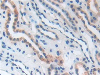 Immunohistochemistry (Formalin/PFA-fixed paraffin-embedded sections) - Anti-CD276 antibody (AB232791)