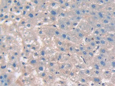 Immunohistochemistry (Formalin/PFA-fixed paraffin-embedded sections) - Anti-CD276 antibody (AB232791)