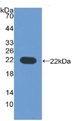 Western blot - Anti-CD276 antibody (AB232791)
