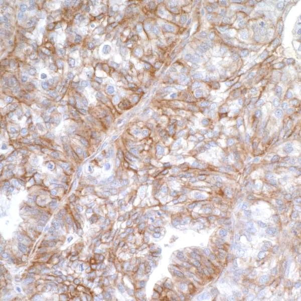 Immunohistochemistry (Formalin/PFA-fixed paraffin-embedded sections) - Anti-CD276 antibody [BLR025F] - BSA free (AB243882)