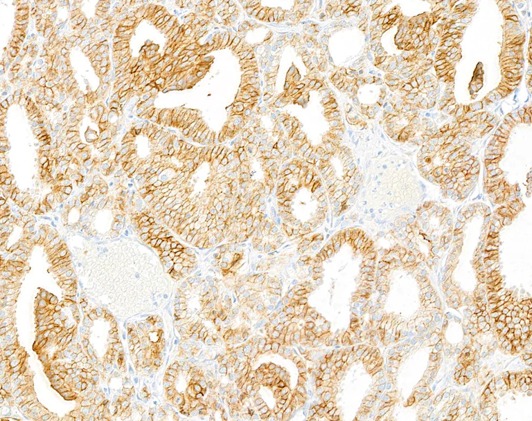 Immunohistochemistry (Formalin/PFA-fixed paraffin-embedded sections) - Anti-CD276 antibody [BLR025F] - BSA free (AB243882)