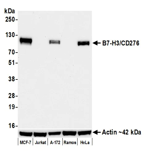 Western blot - Anti-CD276 antibody [BLR025F] - BSA free (AB243882)
