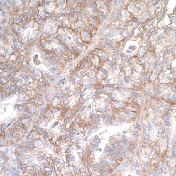 Immunohistochemistry (Formalin/PFA-fixed paraffin-embedded sections) - Anti-CD276 antibody [BLR026F] - BSA free (AB243883)