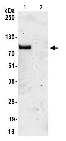 Immunoprecipitation - Anti-CD276 antibody [BLR026F] - BSA free (AB243883)